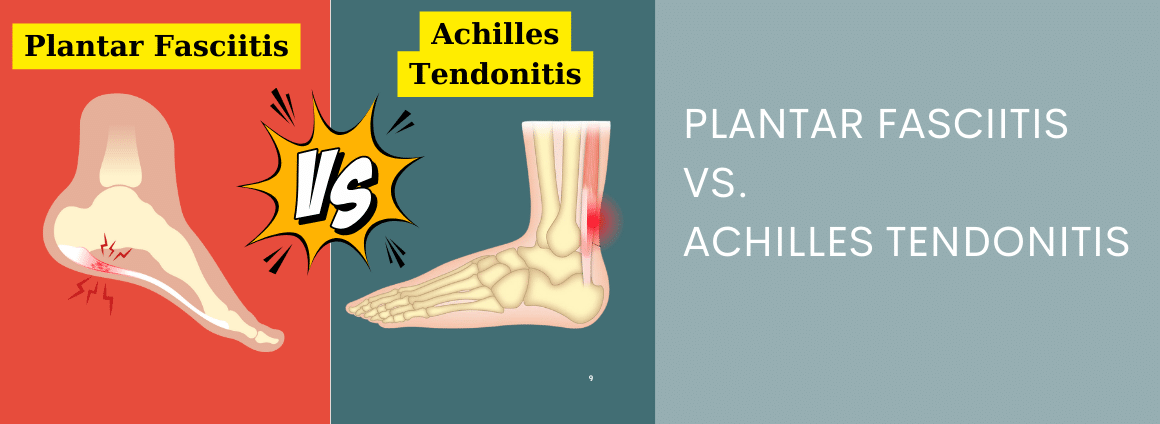 An image showing the difference between plantar fasciitis versus achilles tendonitis.