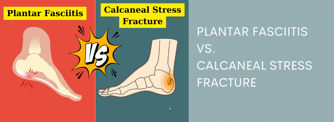 Plantar fasciitis vs calcaneal stress fracture.