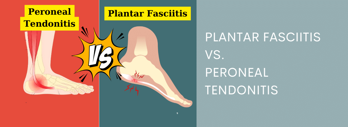 Showing plantar fasciitis and peroneal tendonitis with text overlay Plantar Fasciitis vs. Peroneal Tendonitis