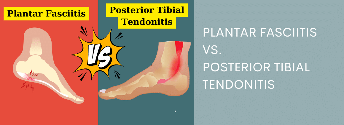 Showing plantar fasciitis versus posterior tibial tendonitis.