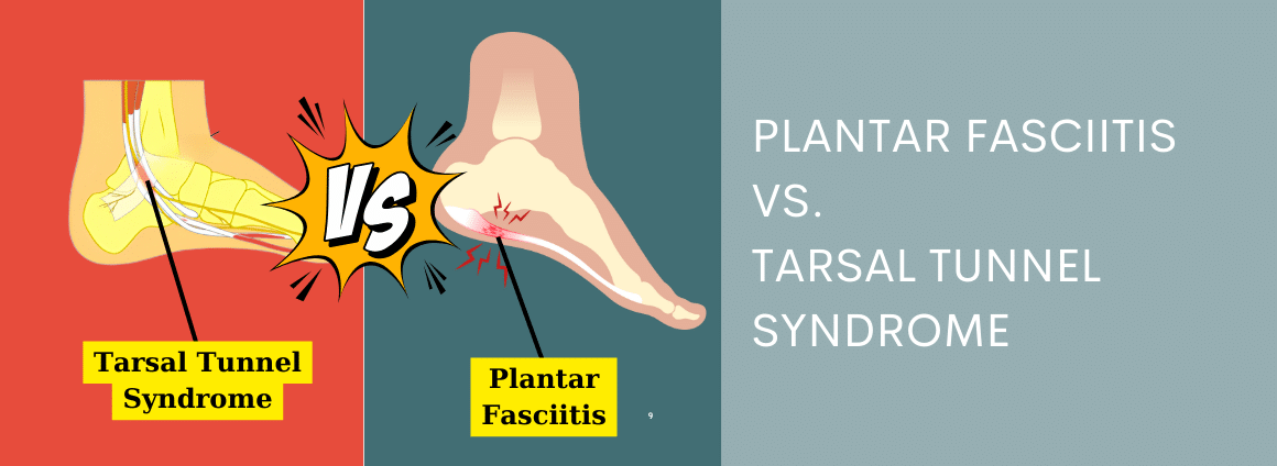 Plantar fasciitis versus tarsal tunnel syndrome with text overlay.